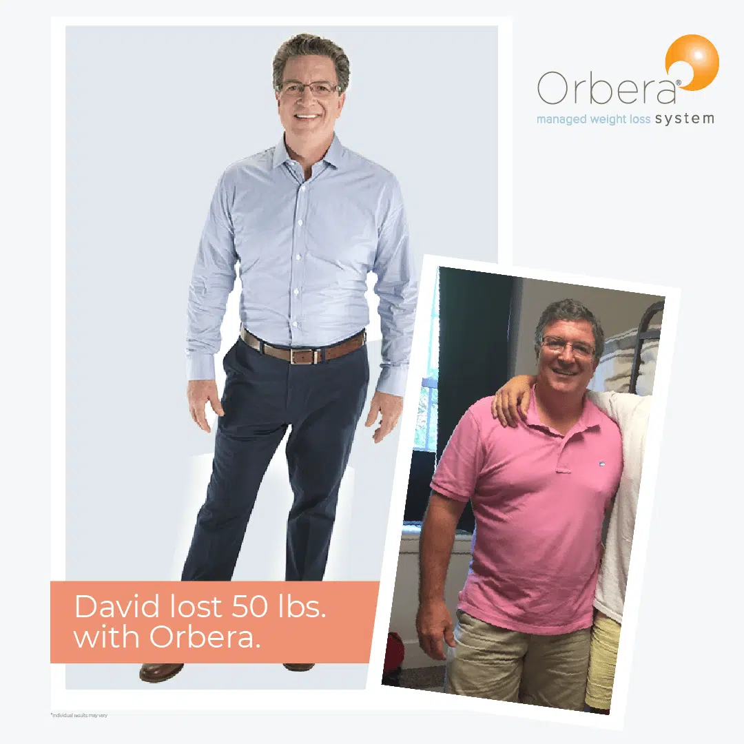 Man's amazing results from orbera gastric balloon before and after 50 lbs with help from bodymorph md in yonkers, ny.
