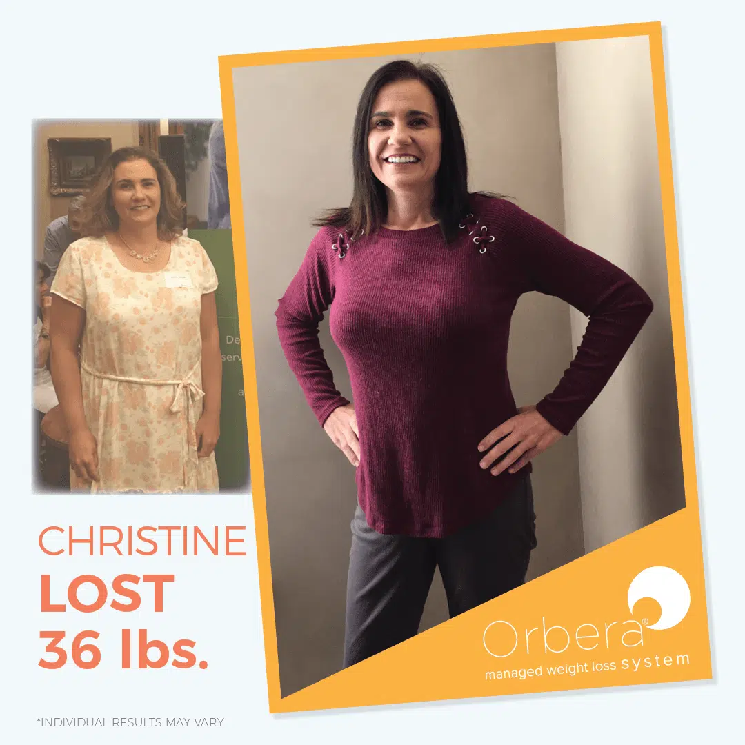 Orbera weight loss before and after in Harrison, NY