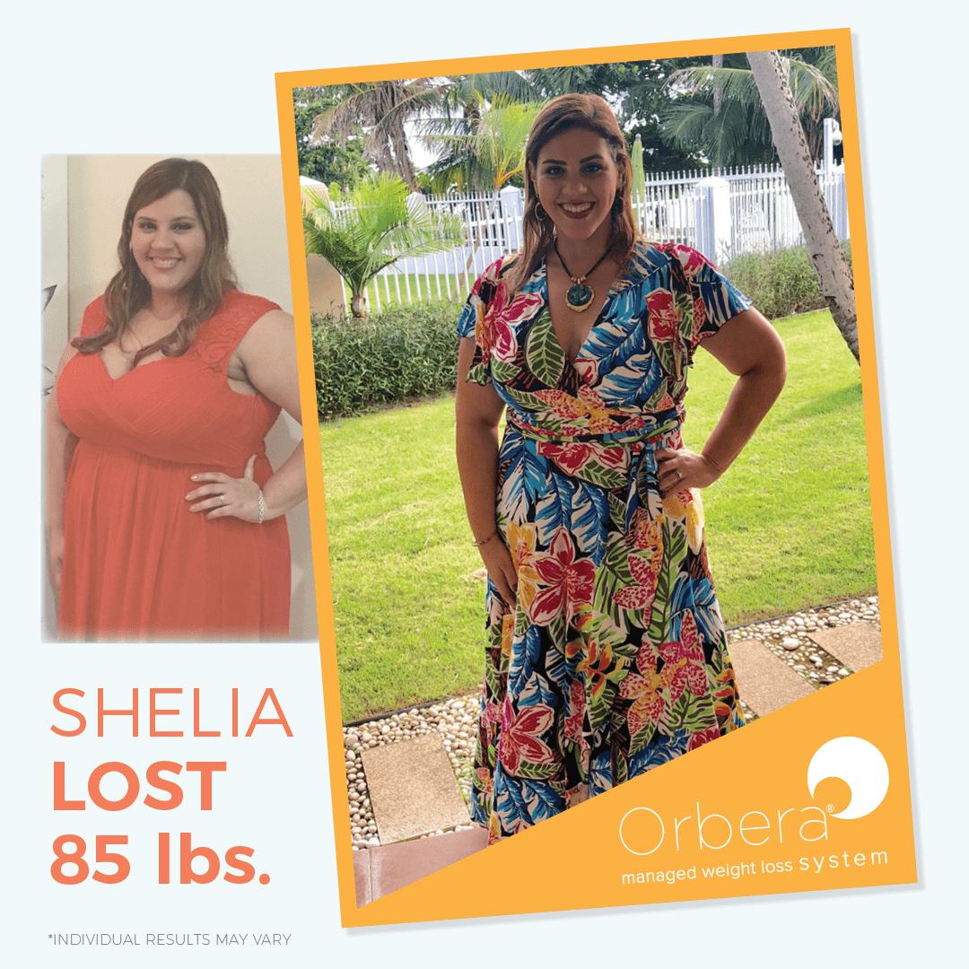 Woman's stunning results from orbera before and after 85 pounds of weight lost with help from bodymorph md in Westchester, ny.